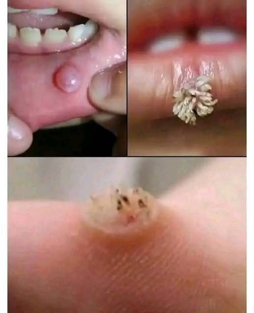BE VERY CAREFUL 🤧🤧 . If you get this, you are infected with …. See more