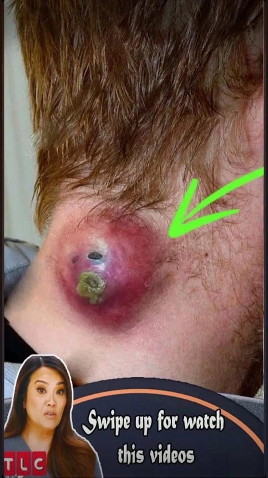 Changes in the Face That Indicate Serious Health Issues